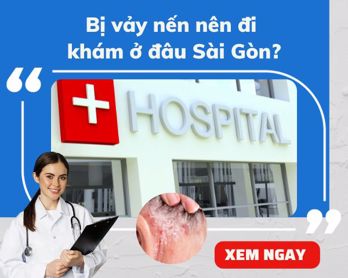 Ở Sài Gòn, bệnh viện khám bệnh vảy nến nào uy tín?
